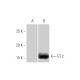 Endothelin-2/EDN2/ET-2 Antibody (3B4-1C5) - Western Blotting - Image 347548 