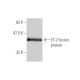 Endothelin-2/EDN2/ET-2 Antibody (3B4-1C5) - Western Blotting - Image 348470