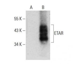 ETAR Antibody (F-12) - Western Blotting - Image 384675