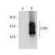 ETAR Antibody (F-12) - Western Blotting - Image 384675