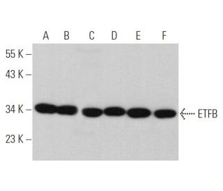ETFB Antibody (E-10) - Western Blotting - Image 375955 