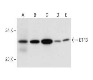 ETFB Antibody (F-1) - Western Blotting - Image 332809 