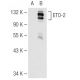 ETO-2 Antibody (D-4) - Western Blotting - Image 67193