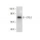 ETO-2 Antibody (D-4) - Western Blotting - Image 303849 
