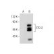 ETO-2 Antibody (G-7) - Western Blotting - Image 287810 