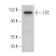 EVC Antibody (H-1) - Western Blotting - Image 369428