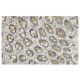 Exo70 Antibody (ZZ-7) - Immunohistochemistry - Image 36137 