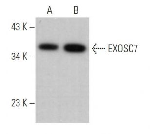 EXOSC7 Antibody (A-1) - Western Blotting - Image 367167 