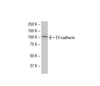 EY-cadherin Antibody (YB.2) - Western Blotting - Image 33441SAM Transcription Activation: SAM system utilizing dCas9-VP64, MS2-P65-HSF1, and sgRNA for precise gene transcription activation.