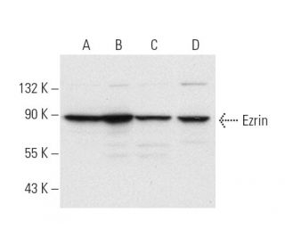 Ezrin Antibody (4A5) - Western Blotting - Image 9931 