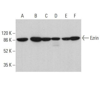 Ezrin Antibody (4i251) - Western Blotting - Image 379861 