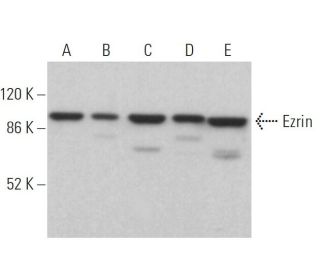 Ezrin Antibody (5G110) - Western Blotting - Image 379263 
