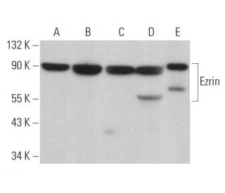 Ezrin Antibody (6A84) - Western Blotting - Image 379267 