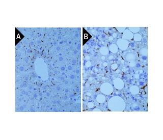 F4/80 Antibody (BM8) - Immunohistochemistry - Image 391714 
