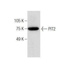 PiT2 Antibody (B-4) - Western Blotting - Image 283614 