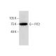 PiT2 Antibody (B-4) - Western Blotting - Image 283614 