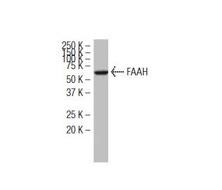 FAAH Antibody (27-Y) - Western Blotting - Image 34113Each CRISPR/Cas9 Knockout (KO) Plasmid product consists of a pool of 3 plasmids designed to ensure identification and cleavage of a specific gene for maximum knockout efficiency. Each plasmid encodes a unique 20 nt sequence derived from the GeCKO (v2) library.