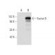 Factor B Antibody (9B6) - Western Blotting - Image 59959