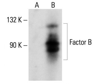 Factor B Antibody (F-7) - Western Blotting - Image 135438