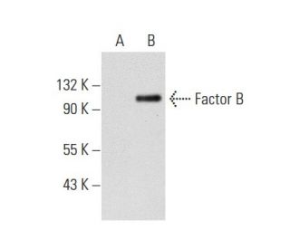Factor B Antibody (D22/3) - Western Blotting - Image 59956