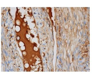 Factor H Antibody (C18/3) - Immunohistochemistry - Image 287069 