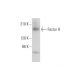 Factor H Antibody (D-8) - Western Blotting - Image 318464 