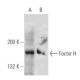 Factor H Antibody (L20/3) - Western Blotting - Image 20456 