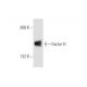 Factor H Antibody (OX23) - Western Blotting - Image 57642