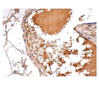 Factor H Antibody (OX24) - Immunohistochemistry - Image 156764 