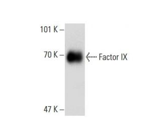 Factor IX Antibody (133-09) - Western Blotting - Image 138628