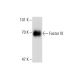 Factor IX Antibody (133-09) - Western Blotting - Image 138628