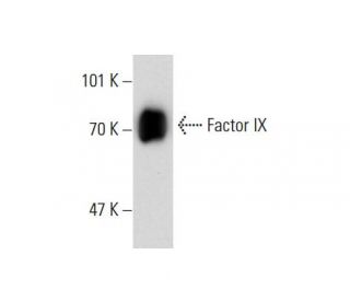 Factor IX Antibody (GMA-124) - Western Blotting - Image 138633