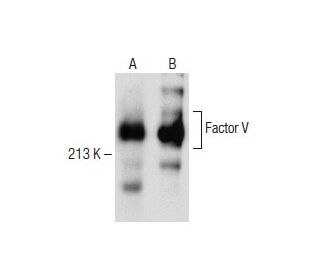Factor V Antibody (AHV-5110) - Western Blotting - Image 150249