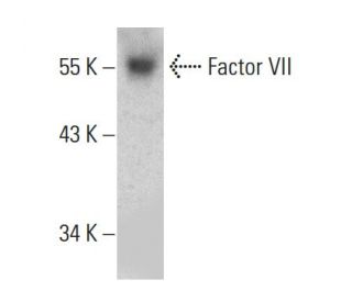 Factor VII Antibody (RFF-VII/2) - Western Blotting - Image 387370SAM Transcription Activation: SAM system utilizing dCas9-VP64, MS2-P65-HSF1, and sgRNA for precise gene transcription activation.