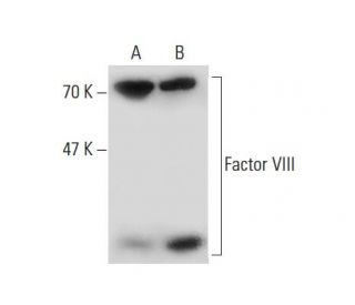 Factor VIII Antibody (102) - Western Blotting - Image 138623