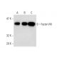 Factor VIII Antibody (GMA-012) - Western Blotting - Image 138624 