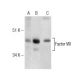 Factor VIII Antibody (R8B12) - Western Blotting - Image 281651 