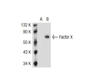 Factor X Antibody (AHX-5050) - Western Blotting - Image 36821The Double Nickase Plasmid features a U6 promoter for sgRNA expression, a 20 nt targeting sequence, and a gRNA scaffold to guide Cas9n. It includes a CBh promoter for Cas9n (D10A) and puromycin resistance, GFP for transfection verification, and nuclear localization signals (NLS). The 2A peptide allows co-expression of Cas9n and Puro from a single promoter, enabling precise genome editing with reduced off-target effects.