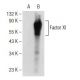 Factor XI Antibody (G-2) - Western Blotting - Image 146842