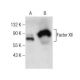 Factor XII Antibody (C-8) - Western Blotting - Image 159001