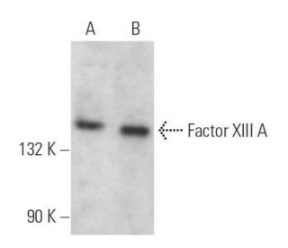 Factor XIII A Antibody (A-4) - Western Blotting - Image 358989 
