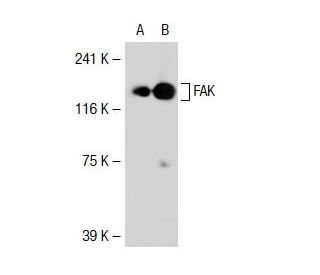 FAK (12G4): sc-56901. Western blot analysis of FAK expression in... 