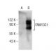 FAM13C1 Antibody (E-5) - Western Blotting - Image 158294