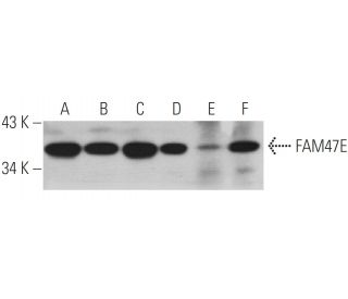FAM47E Antibody (H-11) - Western Blotting - Image 346478 