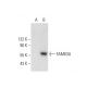 FAM63A (F-3): sc-398287. Western blot analysis of FAM63A expression in non-transfected: sc-117752 (A) and human FAM63A tra