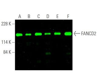 FANCD2 Antibody (FI17) - Western Blotting - Image 375665 