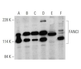 FANCI Antibody (A-7) - Western Blotting - Image 360057 
