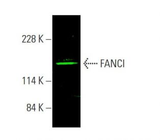 FANCI Antibody (A-7) - Western Blotting - Image 385417
