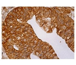 FANCL Antibody (B-11) - Immunohistochemistry - Image 158177 