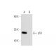 Farnesyl Thiosalicylic Acid Amide: sc-223986. Western blot analysis of p53 expression in untreated (A) and Farnesyl Thiosa